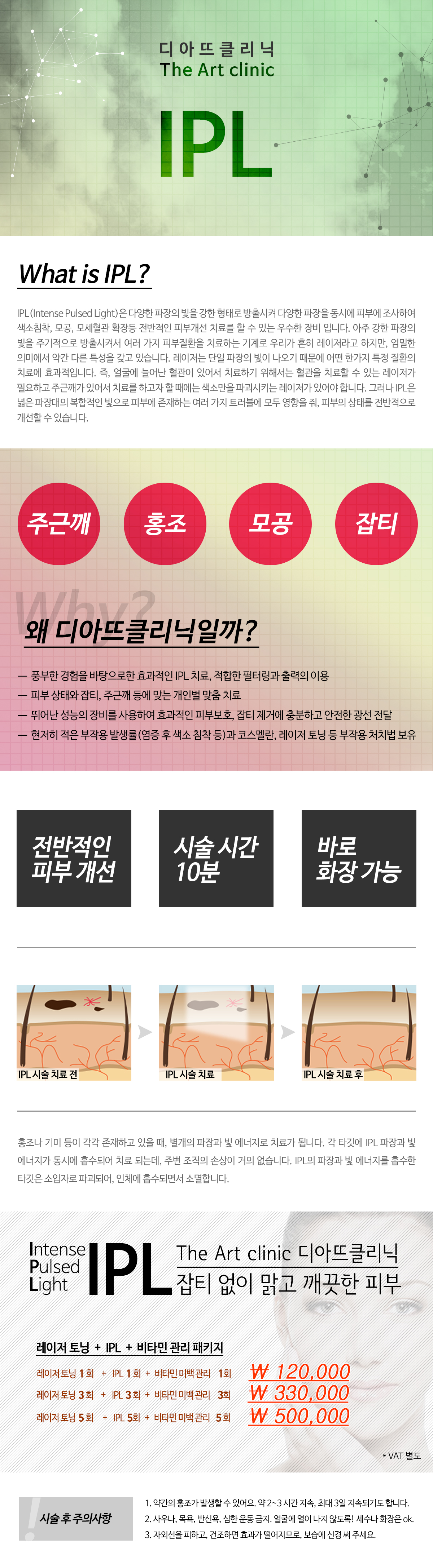 IPL 대표 이미지 1